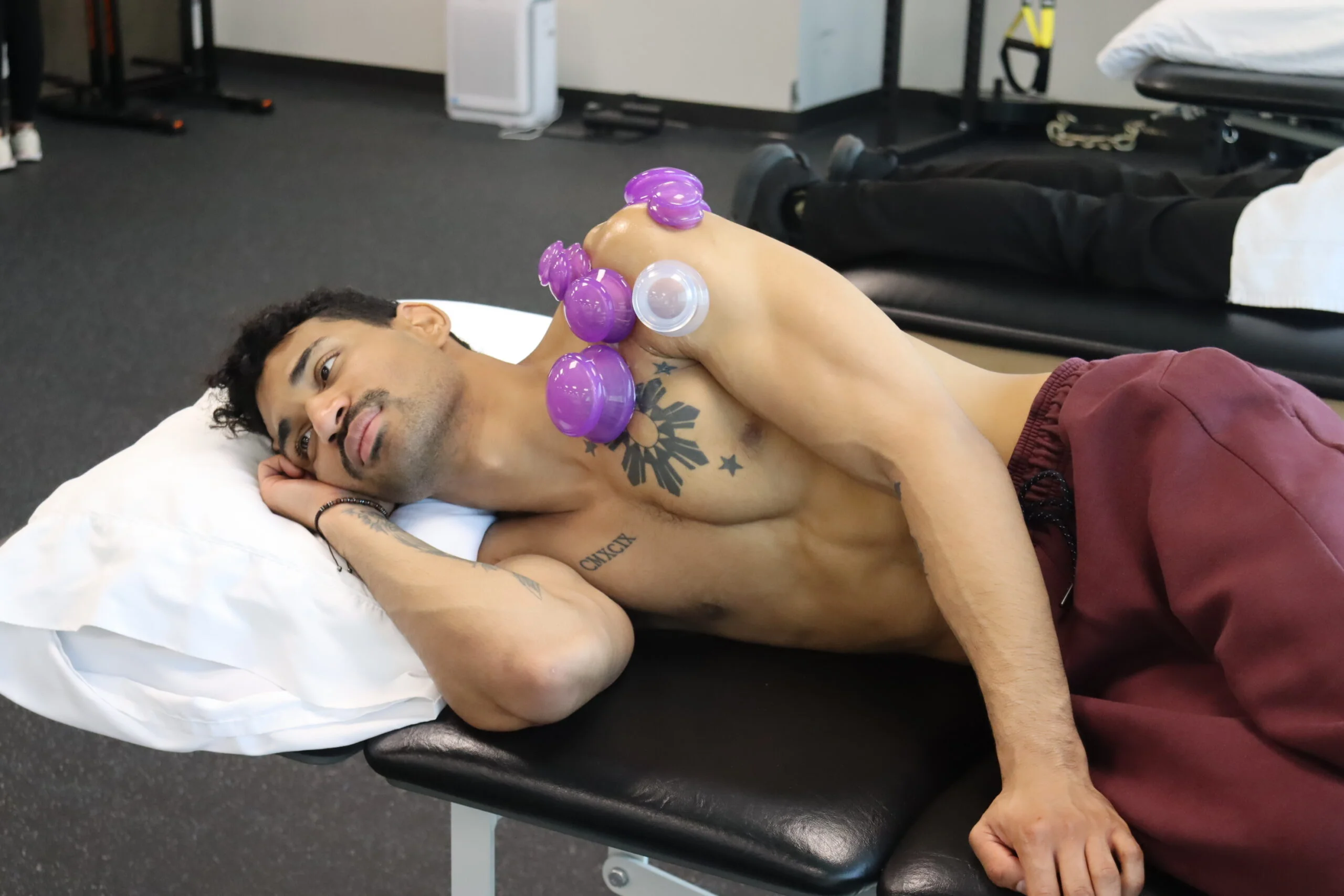 Patient with cupping along shoulders and chest