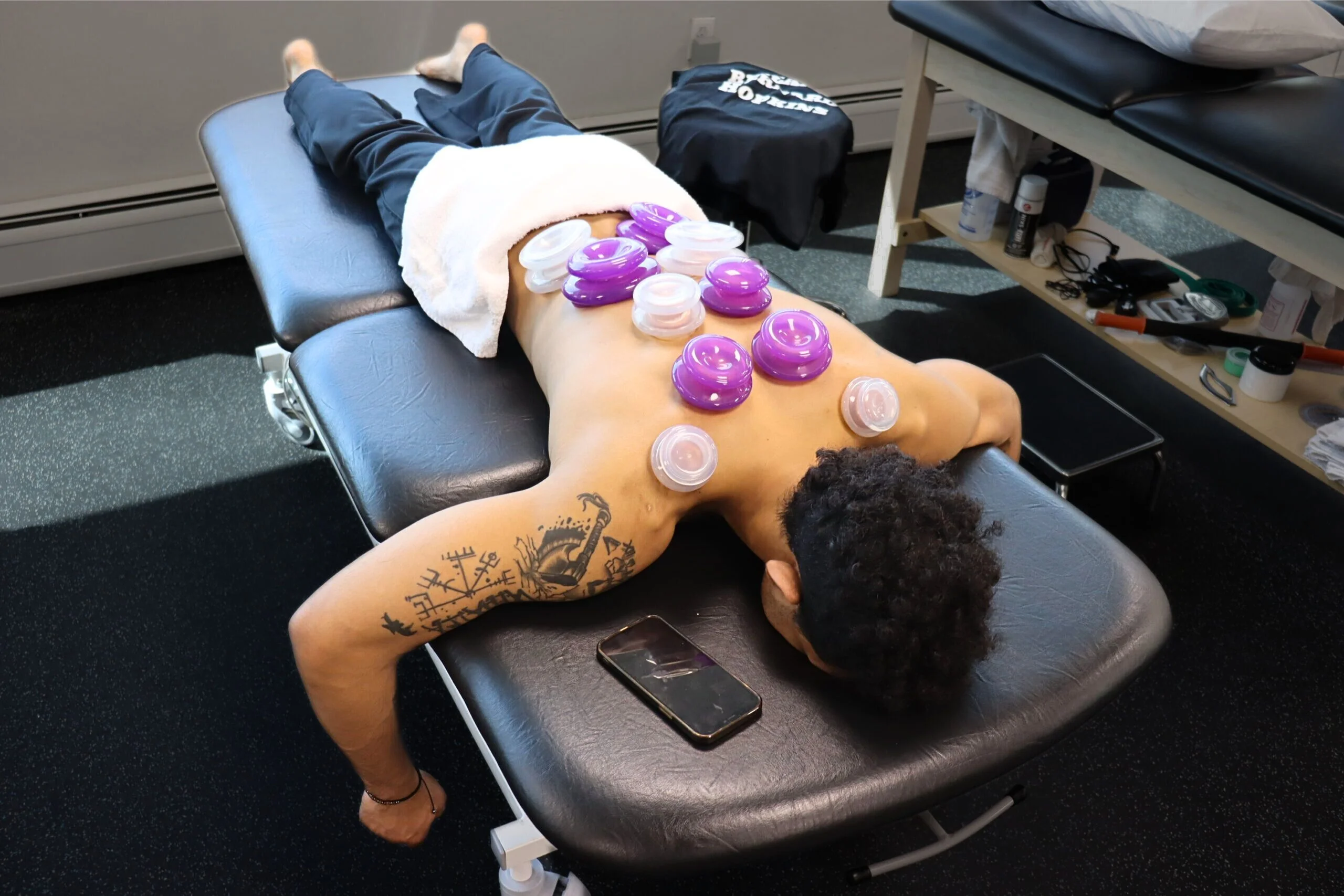 Cupping on entire back