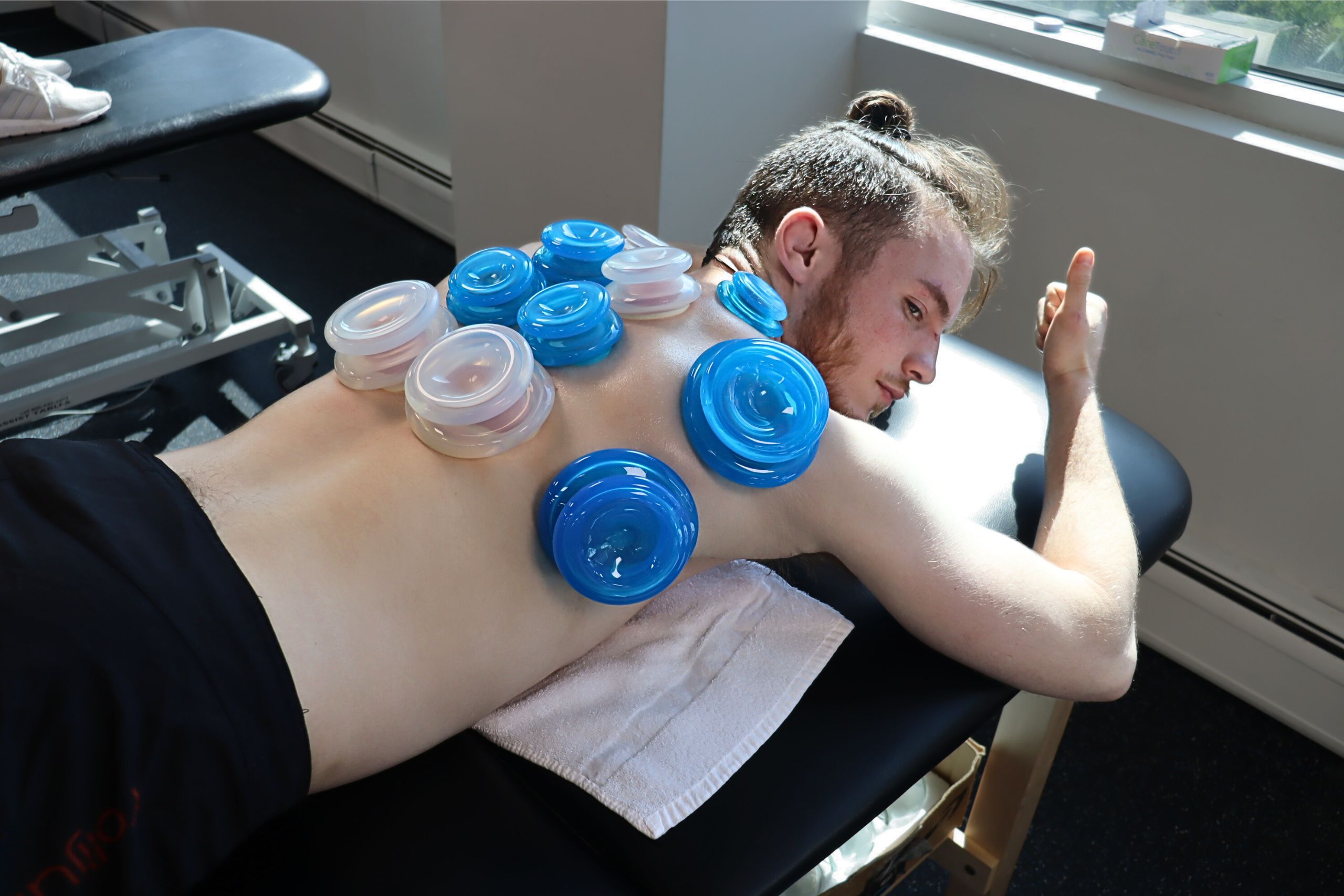 Cupping on patient back