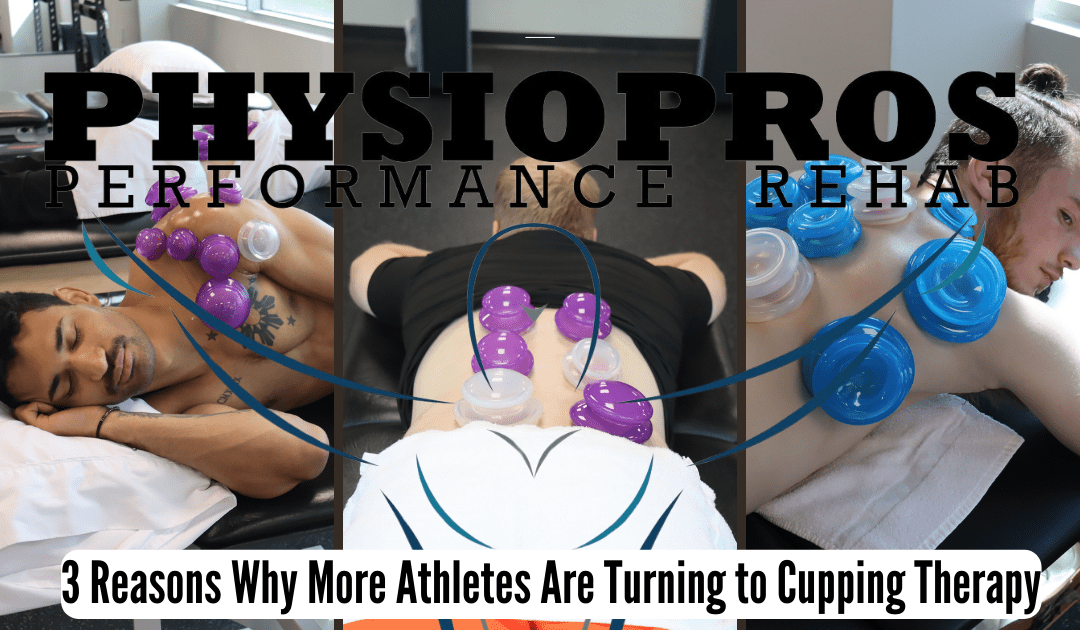 3 Reasons Why More Athletes Are Turning to Cupping Therapy