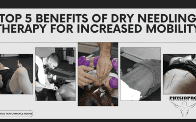 Top 5 Benefits of Dry Needling Therapy for Increased Mobility