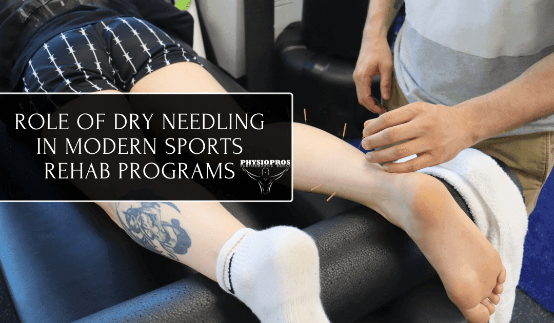 The Role of Dry Needling in Modern Sports Rehab Programs