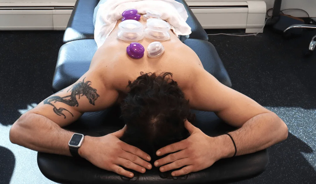 Physical Therapy Parsippany, NJ | Cupping After Massage: The Perfect Combo for Muscle Relief? Cupping After Massage Blog Post.