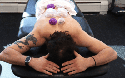 Physical Therapy Parsippany, NJ | Cupping After Massage: The Perfect Combo for Muscle Relief? Cupping After Massage: The Perfect Combo for Muscle Relief?