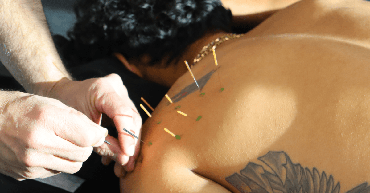 Dry Needling Physiopros NJ 