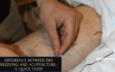 Physical Therapy Parsippany, NJ | Difference Between Dry Needling and Acupuncture: A Quick Guide Difference Between Dry Needling and Acupuncture: A Quick Guide