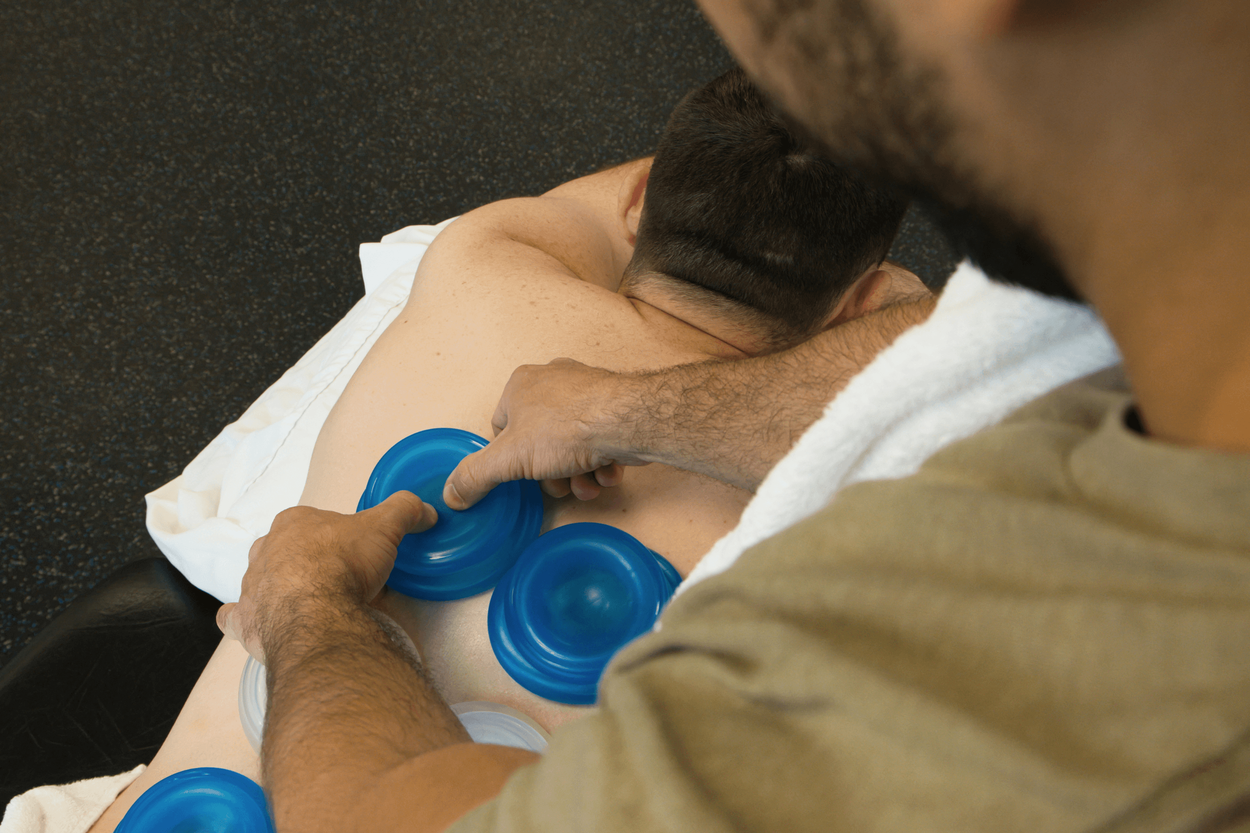 Physical Therapy Parsippany, NJ | Our Gallery Cupping Therapy Physiopros