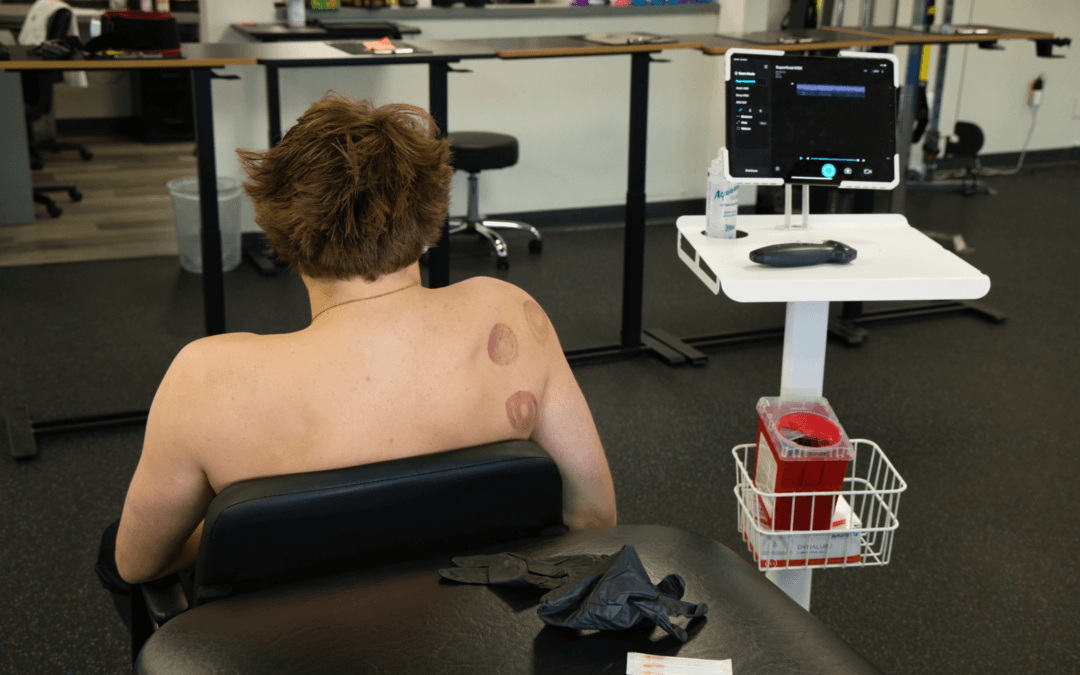 Physical Therapy Parsippany, NJ | Ultrasound Guided Dry Needling: What’s Different? Ultrasound guided dry needling (blog post)