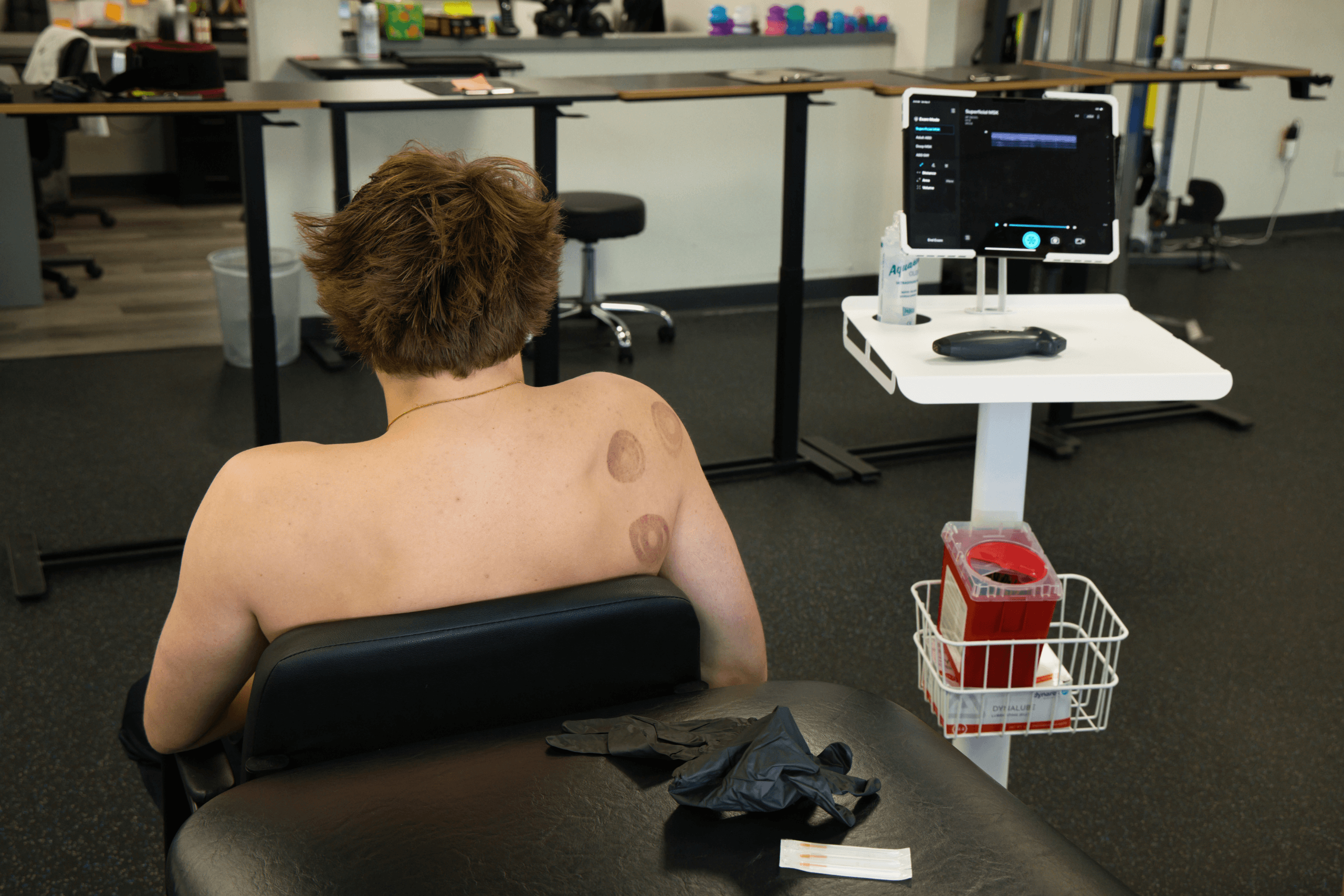 Ultrasound Guided Dry Needling Differences